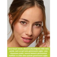 Defne Store Siyah Nokta, Sivilce ve Akne Karşıtı, Gözenek Sıklaştırıcı Cilt Serumu Pelargonium Niacinamide Hyaluronic Acid Panthenol 30 ml
