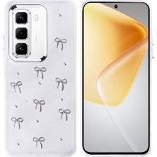 Alstrap Vivo V30 Lite Uyumlu Parlak Şeffaf Silikon Kılıf Metal Desenli Darbe Emici Koruma