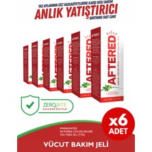 Aftered Anlık Yatıştırıcı 6'lı Eko Set - Yaz Aylarının Cilt Hassasiyetlerine Karşı 6X50ML