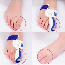 TeknoKapsül Ayak Baş Parmak Kemik Çıkıntı Düzeltici Hallugs Valgus 1 Çift