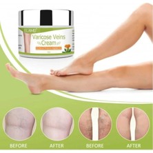 Bezos Varicose Veins Var.is Kremi 100 ml