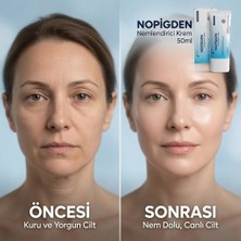 denge ilaç nopigden nemlendirici onarıcı krem 50 ml günlük cilt bakım ve nemlendirme kremi