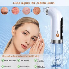 Mi Land Vakumlu Cilt Gözenek Temizleyici 6 Başlıklı Su/Serum ile Siyah Nokta Temizleme Aleti