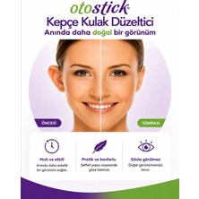 Otostick Yetişkin (Kozmetik Kepçe Kulak Düzeltici Bant) Tekli Paket