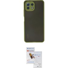 Nuveden Ieg™ Mi 11 Lite Kılıf Ahenk Çizgi Serisi - Siyah Seramik Nano Ekran Koruyucu