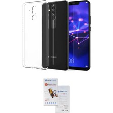 Nuveden Ieg™ Mate 20 Lite Kılıf Zirve Doku - Siyah Seramik Nano Ekran Koruyucu