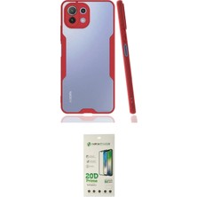 Uravas Store Ieg™ Mi 11 Lite Kılıf Atlas Asil Serisi - Siyah 20D Premium Cam Ekran Koruyucu