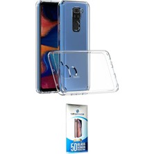 Uravas Store Ieg™ Redmi Note 9 Kılıf Zirve Doku - Siyah 5d Eko Cam Ekran Koruyucu