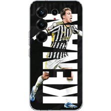 TechTree Tecno Camon 50 Pro 4g Uyumlu Kenan Yıldız Sevinç Baskılı Silikon Kılıf