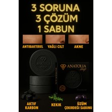 Anatolia Soap Aktif Karbon Sabunu Arındırıcı Gözenek Arındırıcı Yağ Dengeleyici Saç Derisi Bakımı