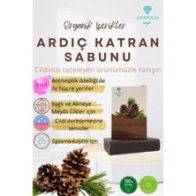 Anatolia Soap Ardıç Katranı Sabunu Mantar Karşıtı Saç Dökülmesine Karşı Kepek Karşıtı Arındırıcı