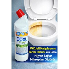 Poxy Wc Jel 1 lt Üre Taşı Sararmış Kalıplaşmış Tartar İzlerinde Etkılıdir.