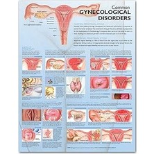 Nacario Common Gynecological Disorders Anatomical Chart