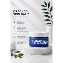 Nacario Çatlak Deri Balsamı, Sea Buckthorn, Tamanu Oil, Calendula Jojoba Ile, Nemlendirici, 50 ml