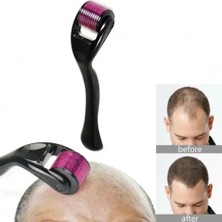 Solmazlar Online Mey Ithalat® Titanyum Derma Roller 1.00 mm