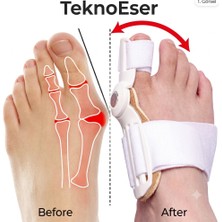 Eser Ticarett Bas Parmak Duzeltici Bunion Corrector Hallux Valgus Ortopedik