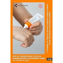 Nacario K Vitaminli Krem - Cilt ve Göz Altı Morlukları ile Kılcal Damar Problemleri Için Krem