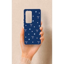 Vip Case Vivo V30 Uyumlu Mini Fiyonk Desenli Silikon Kılıf