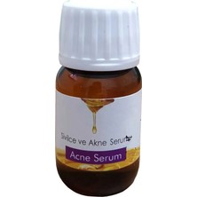 Mbb E-Ticaret Sivilce ve Akne Serumu 20 ml