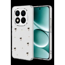 Mudanis Xiaomi Redmi Note 15 Pro Plus 5g Fiyonk Desenli Kapak - Desen 1