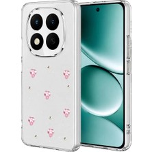 Sb Shopping Redmi Note 15 5g Fiyonk Desenli Kapak - Desen 3