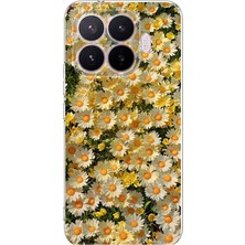 TechTree Xiaomi 17T Pro Uyumlu Papatya Bahçesi Sulu Boya Baskılı Silikon Kılıf