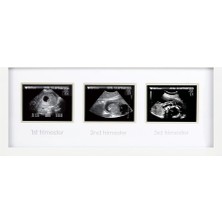 Pearhead 87038 Trimester Sonogram Frame , Çerçevesi Için Üç Ultraschallaufnahmen,