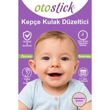 Otostick Baby Kepçe Kulak Düzeltici Bant Tekli Paket