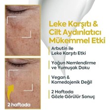 Leke Karşıtı Aydınlatıcı – Yüz Için Koyu Leke Giderici, Siyah Nokta Karşıtı Cilt Bakım Kremi, Komedojenik Olmayan Hafif Nemlendirici, 40 ml (4 Paketi)