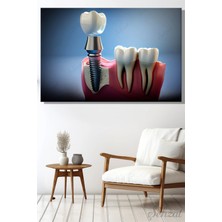 Şehzat Yatay Kanvas Duvar Tablosu Diş Sağlığı Dişçi Klinik Dental Implant Çürük