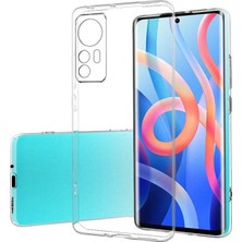 Uray Store Xiaomi Mi 12 Kılıf Lüx Şeffaf Silikon