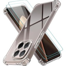 Zg Store Psr Aksesuar Xiaomi Uyumlu Anti-Shock Sert Çerçeveli Koruyucu Kılıf + Temperli Cam Ekran Koruyucu Seti (Xiaomi 15T Pro 5g)