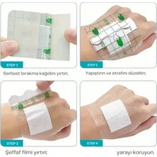 Octacare Şeffaf Su Geçirmez Yara Örtüsü 5cmx9cm Uzun Süreli Güçlü Yapışkan Hipoalerjenik 1Adet
