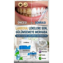 Lanbena Diş Temizleme Tartar Lekesi Giderici 10 ml Diş Beyazlatma Etkisiyle
