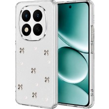 Aslanoğlu Store Xiaomi Redmi Note 15 Pro 4g Fiyonk Desenli Kapak - Desen 8