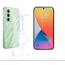 Tekno Grup Xiaomi Redmi 15 Kılıf Mika Kamera Korumalı M-Safe Şarj Özellikli Şeffaf Sert Pc London Kapak + Esnek Nano Ekran Koruyucu