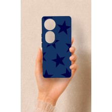 Vip Case Vivo V40 Uyumlu Lacivert Star Desenli Silikon Kılıf