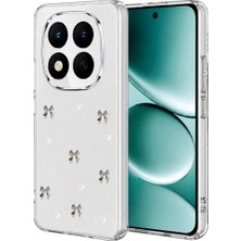 Aydogan's Ayd Xiaomi Redmi Note 15 4g Fiyonk Desenli Kapak - Desen 8