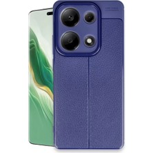 Aydogan's Ayd Xiaomi Redmi Note 13 Pro 4g Kılıf Auto Focus Kapak - Lacivert