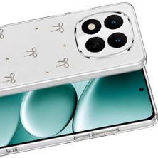 Mey İthalat Mey Ithalat®   Redmi Note 15 Pro 4g Fiyonk Desenli Kapak - Desen 5