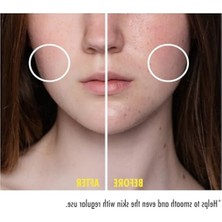 Die Grup 30 ml Niacinamide Içeren Cilt Serumu, Yenileyici Özellik