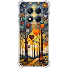 Printify Redmi Note 14 Pro Plus ile Uyumlu Düşlerin Dansı Serisi Yıldız Yolculuğu Tasarımlı Uv Baskılı Köşe Korumalı Antişok Kılıf