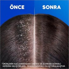 & Shoulders Limon Ferahlığı Kepek Karşıtı Yağlı Saçlar Için Günlük Kullanım 330 ml Şampuan