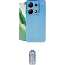 Marsilyan™- Redmi Note 13 Pro 4g Kılıf Doruk Klasik Özel Seri - Siyah Joko Magic 5d Cam