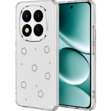 Freedom Storee Xiaomi Redmi Note 15 4g Fiyonk Desenli Kapak - Desen 2