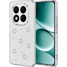 Csmo-Tex Newface Xiaomi Redmi Note 15 Pro 4g Fiyonk Desenli Kapak - Desen 2