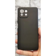 Vendas Ucuzluk Çadırı Xiaomi Mi 11 Lite Uyumlu 3 Parçalı Sert PC Kılıf - Siyah