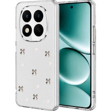 Spt-Gld Newface Xiaomi Redmi Note 15 Pro 4g Fiyonk Desenli Kapak - Desen 8