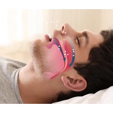 Gees Global Rahat Uyku Için Anti Snore Sleep Horlama Engelleyici Aparat Uyku Stoperi