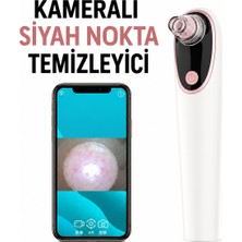 Qasul X-Shinysmart Kameralı Siyah Nokta Temizleme Cihazı - Telefon Uygulamalı - Wifi Bağlantılı